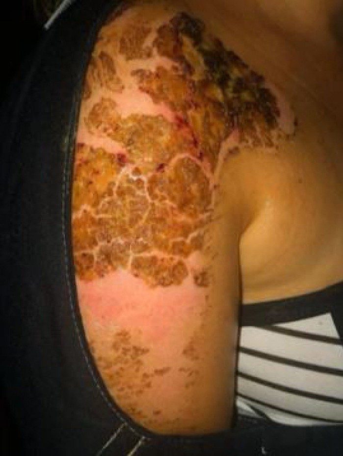 Agress&atilde;o provocada pelo atropelamento que a v&iacute;tima sofreu ap&oacute;s uma briga com o seu namorado e policial militar Bruno Paix&atilde;o