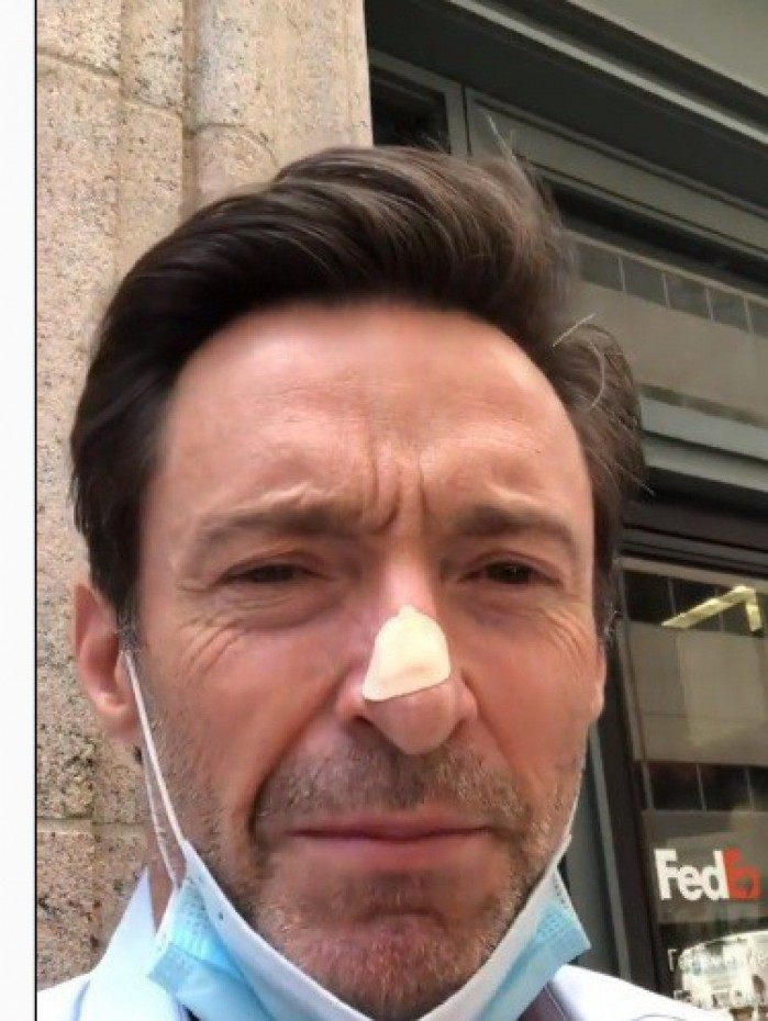 Hugh Jackman
