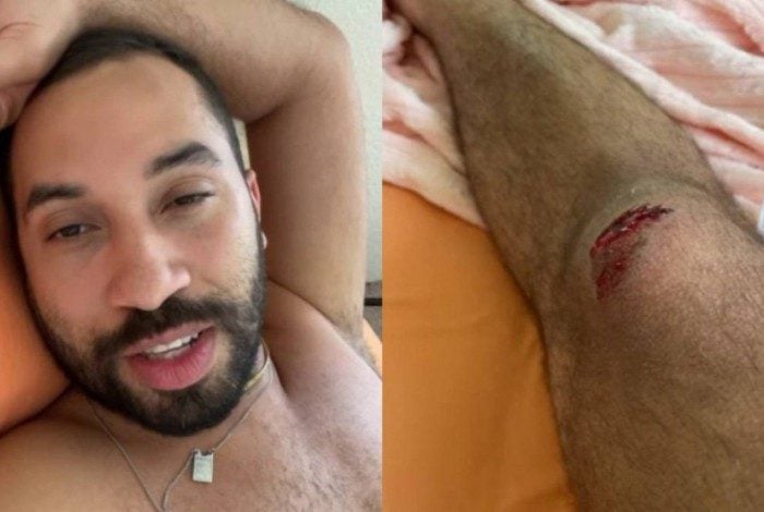 Gil do Vigor sofre acidente de bicicleta nos EUA: 'Quase desmaiei'

