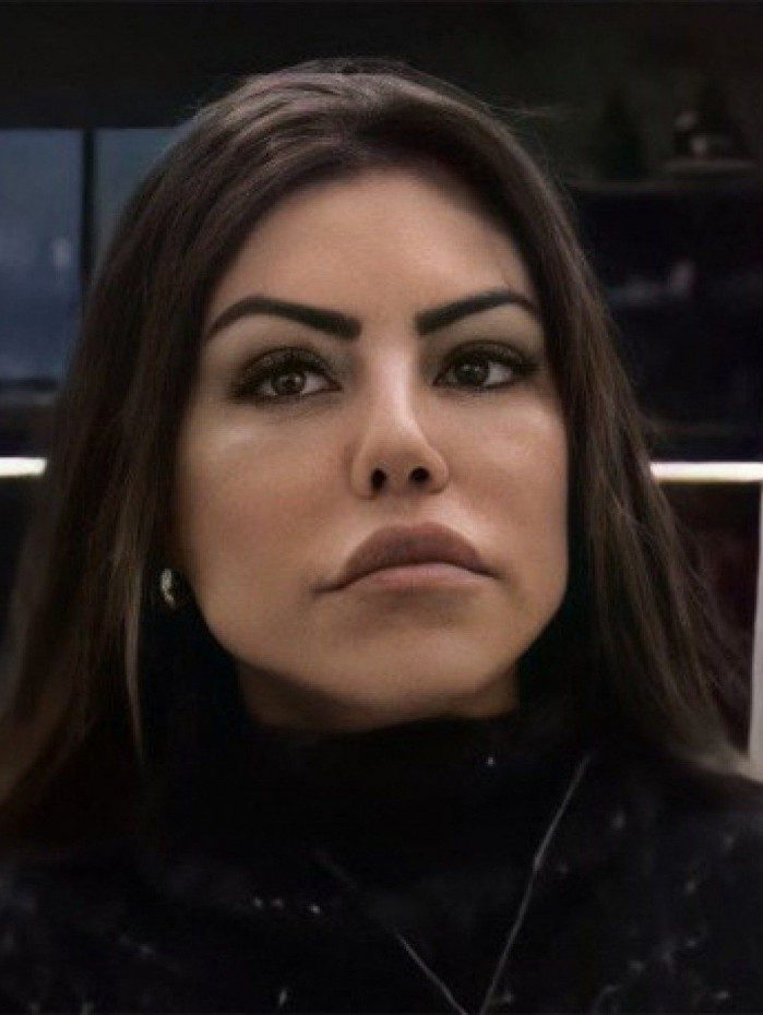 Liziane Gutierrez no confinamento de 'A Fazenda'; ela tem sido alvo de ataques na internet por conta da harmoniza&ccedil;&atilde;o facial