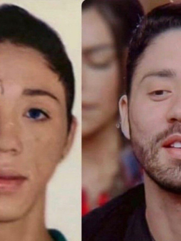 Antes e depois: Rico Melqu&iacute;ades gastou cerca de R$ 70 mil em harmoniza&ccedil;&atilde;o facial