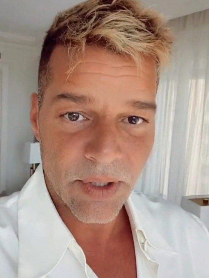 Ricky Martin nega procedimentos no rosto