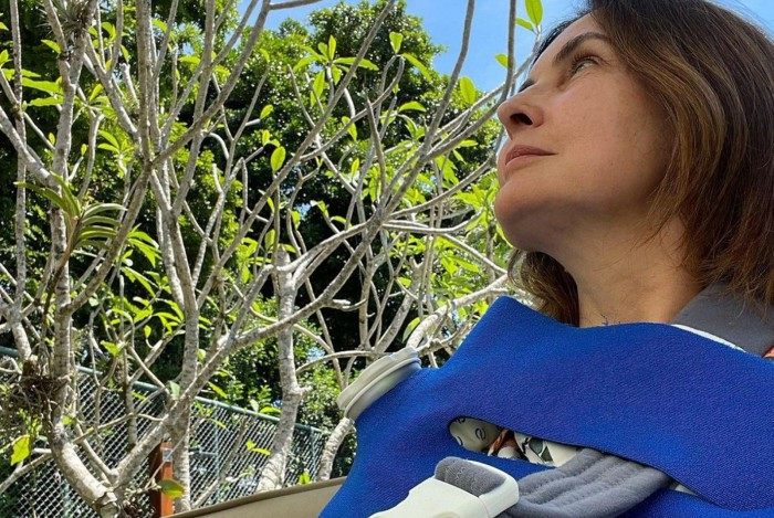 Fátima Bernardes posta selfie após passar por cirurgia no ombro