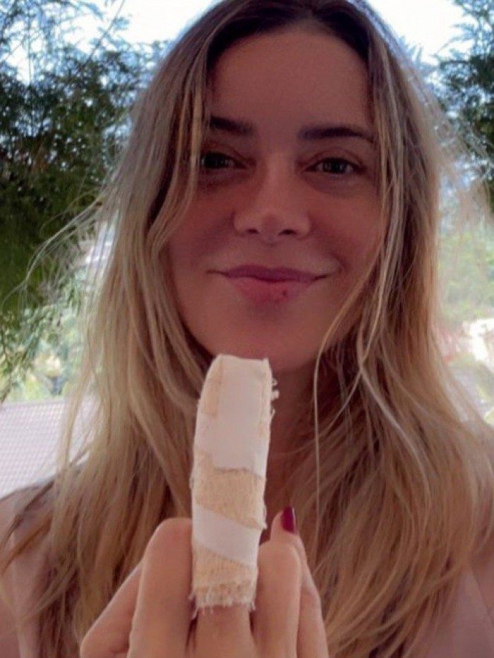Christine Fernandes sofre fratura exposta no dedo