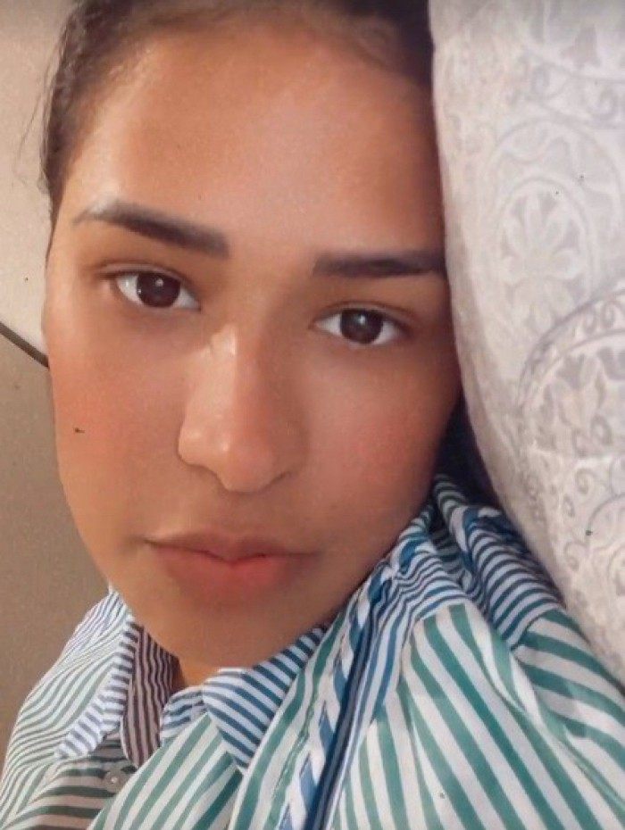 Simone faz cirurgia plástica