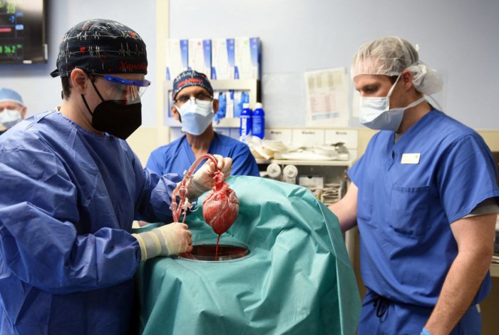 Homem recebe coração de porco durante transplante