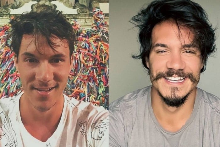 Eliezer, do 'BBB 22', antes e depois da harmonização facial