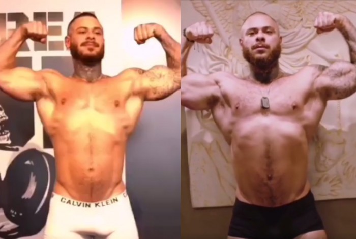 Leo Stronda mostra antes e depois de seu corpo após sofrer acidente com botijão de gás