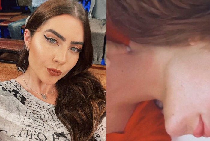 Jade Picon mostra hematoma no pescoço e evita polêmicas ao dizer que se queimou