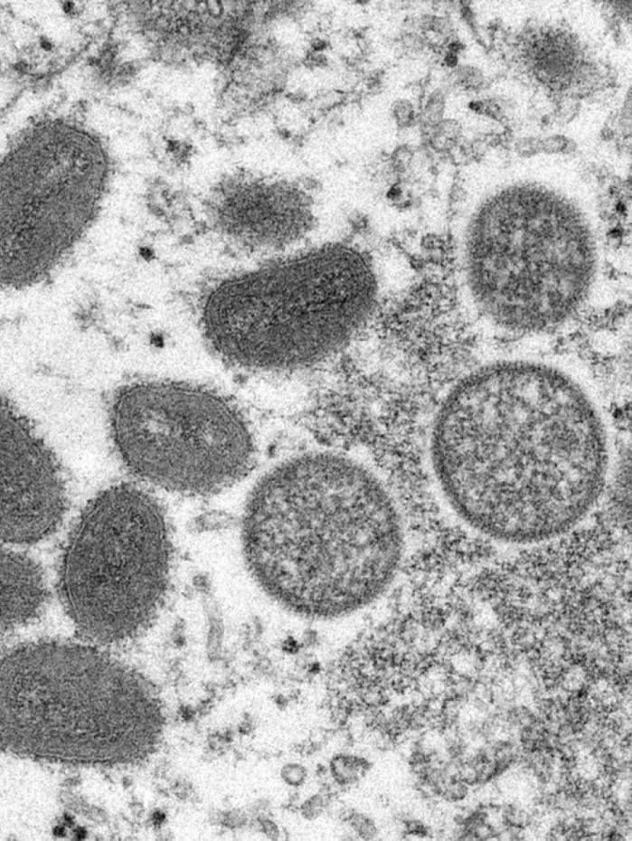 OMS diz que risco global &eacute; moderado