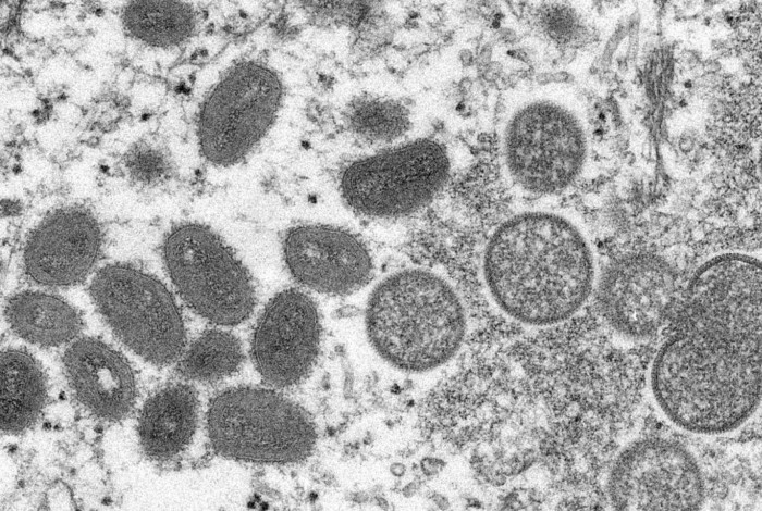 Amostra de vírus da varíola dos macacos
