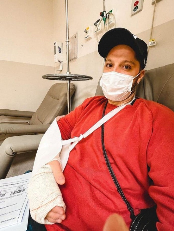 André Vasco precisou engessar o braço após socar parede 