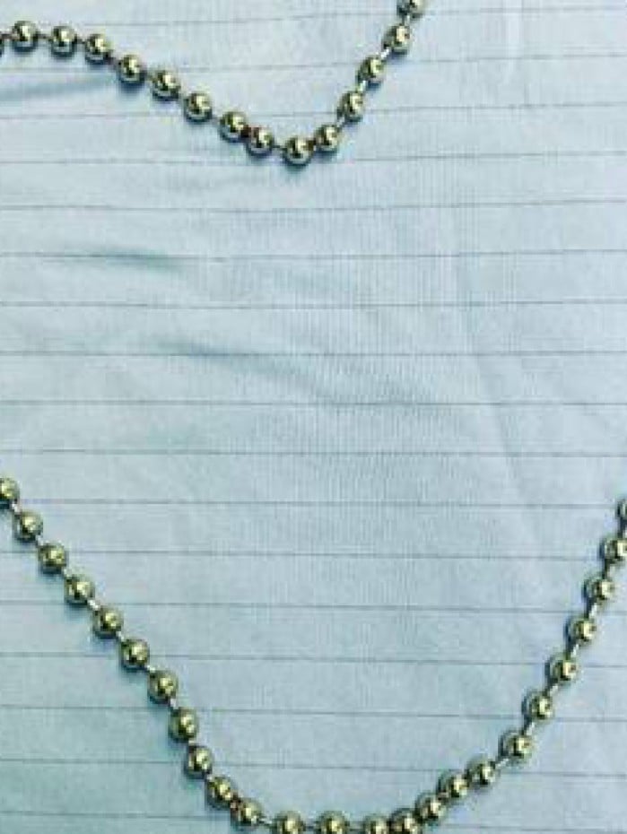 Homem fica com corrente de bolinhas presa no p&ecirc;nis 