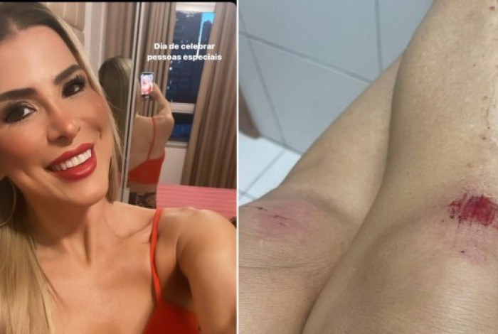 Ex-BBB Milena Fagundes fala que foi agredida em festa de Caprichoso