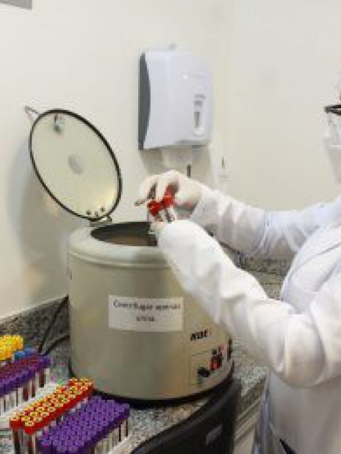 O Laborat&oacute;rio Central de An&aacute;lises Cl&iacute;nicas funciona de segunda a sexta-feira, das 6h &agrave;s 16h