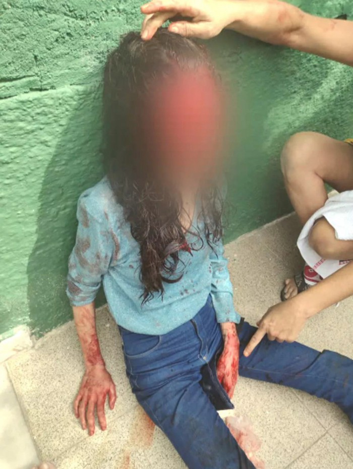 Logo após o ataque, amigos foram socorrer a designer Jessyca Lopes, que ficou toda ensanguentada