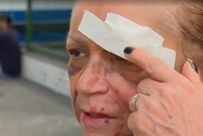 A idosa ficou com vários hematomas pelo rosto