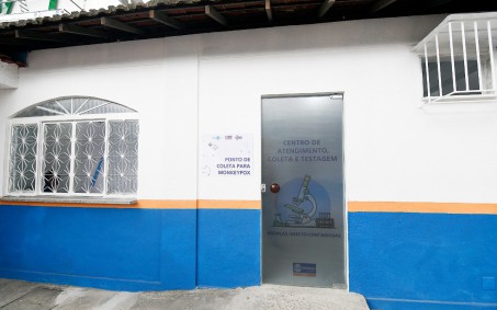 Nova Iguaçu tem posto de referência em testagem da Varíola dos Macacos