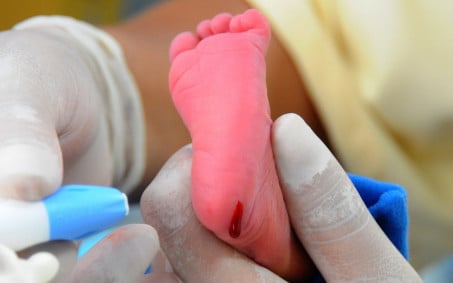 Maternidade de Nova Iguaçu realiza exames no Dia Nacional do Teste do Pezinho