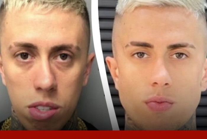 Antes e depois de MC Daniel ap&oacute;s procedimentos est&eacute;ticos