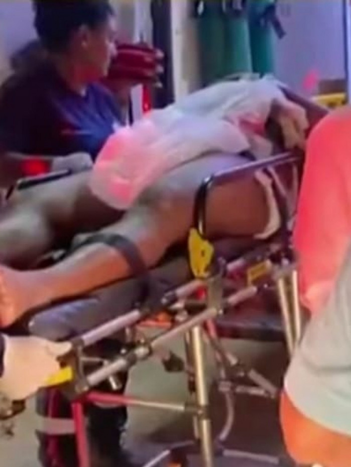 Tiroteio deixou criança ferida. Vítimas foram levadas para UPA da região e para o Hospital Adão Pereira Nunes, em Duque de Caxias