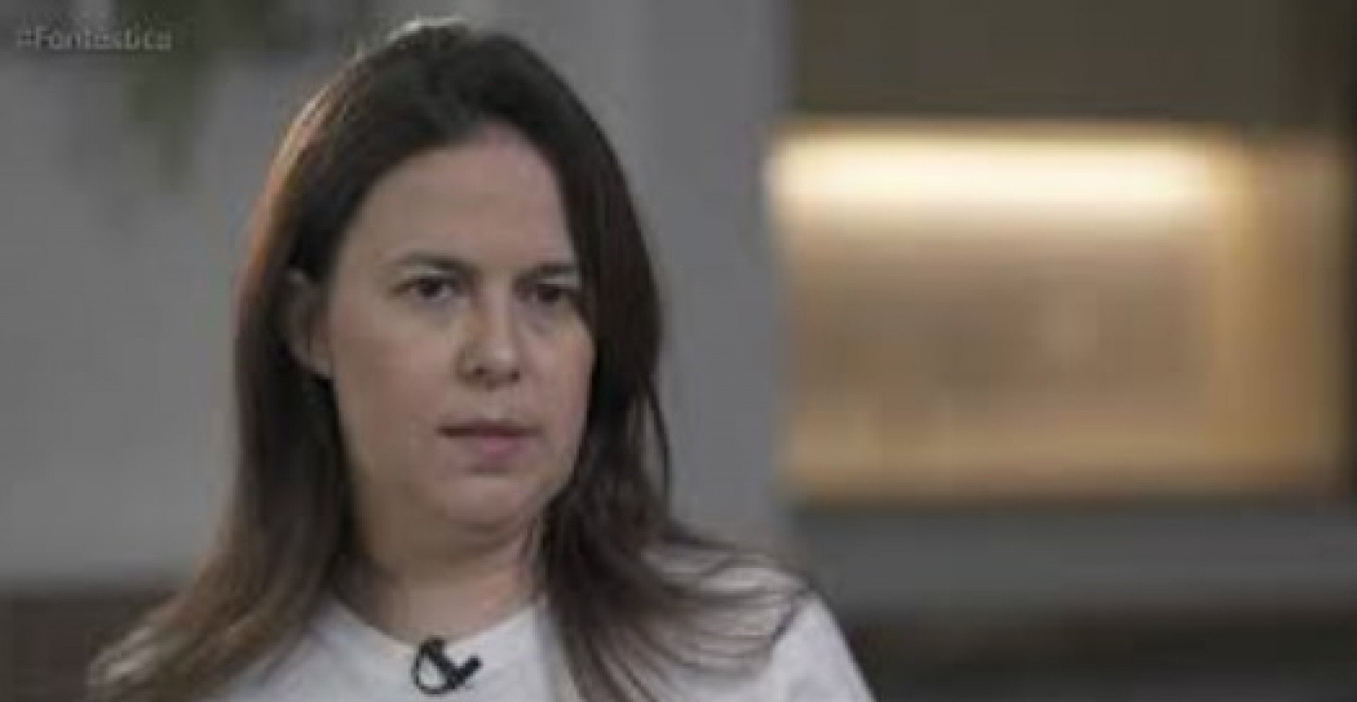 Radharani Domingos, de 43 anos, est&aacute; a 18 dias sem enxergar ap&oacute;s a contamina&ccedil;&atilde;o e ficou internada por 15 dias at&eacute; receber alta