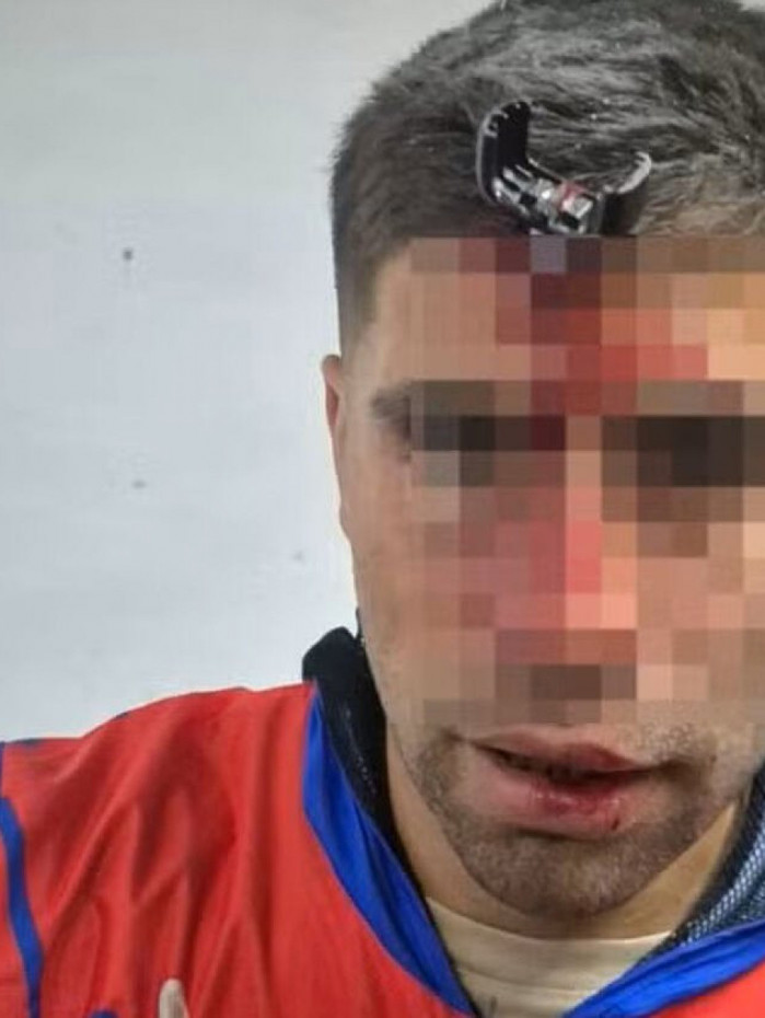 Jogador passa por cirurgia ap&oacute;s ser atingido por chave de carro na testa