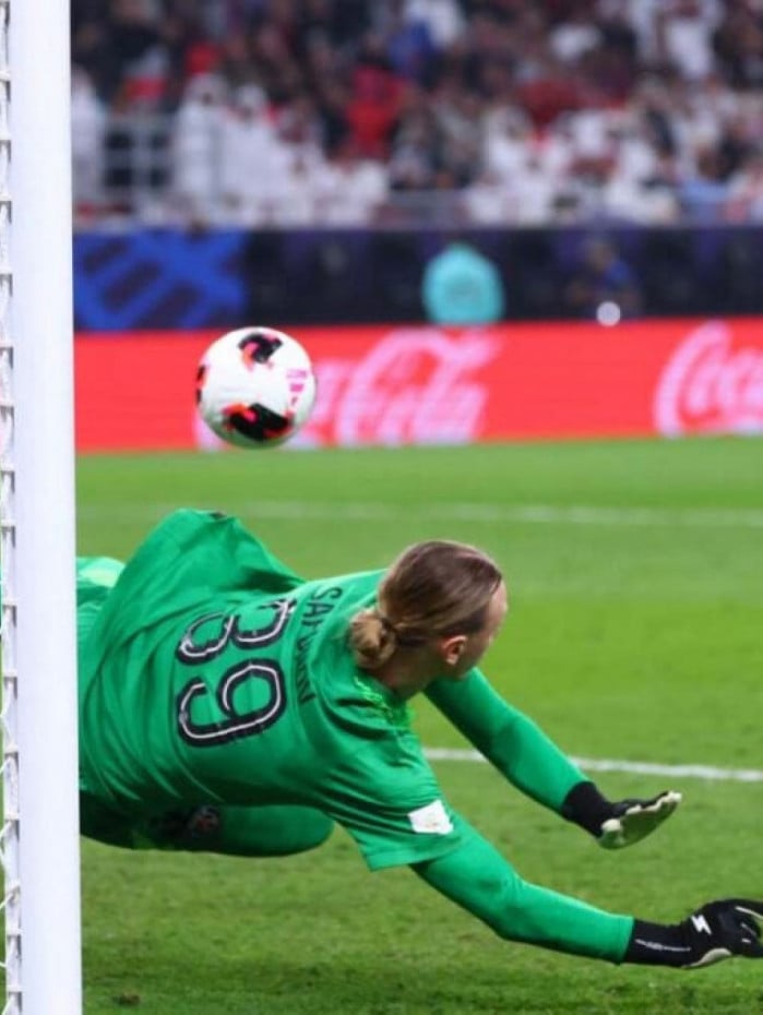 Her&oacute;i do PSG contra o Flamengo, goleiro fraturou a m&atilde;o na final