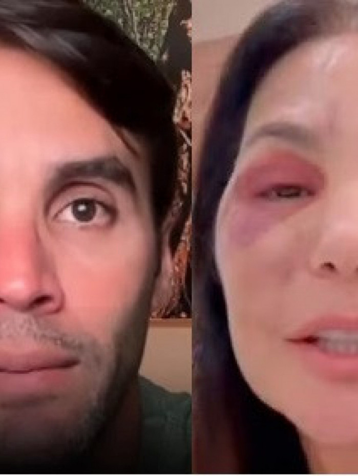 Daniel Cady fala sobre estado de sa&uacute;de de Ivete Sangalo