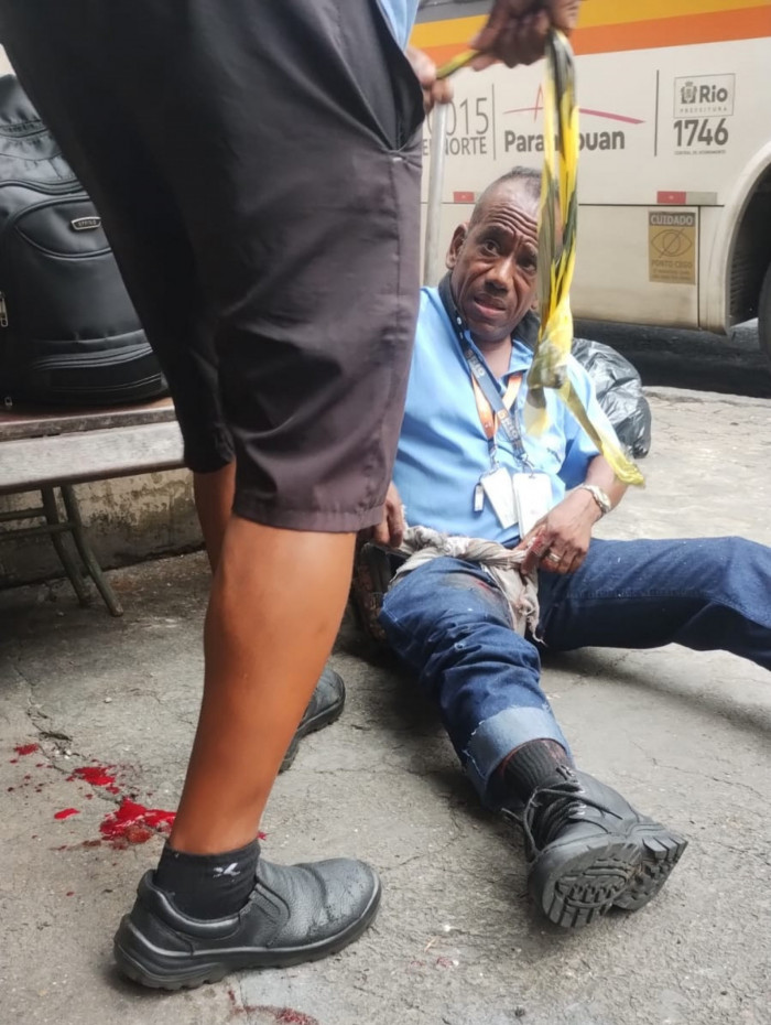 Motorista ficou ferido por estilha&ccedil;os na perna 