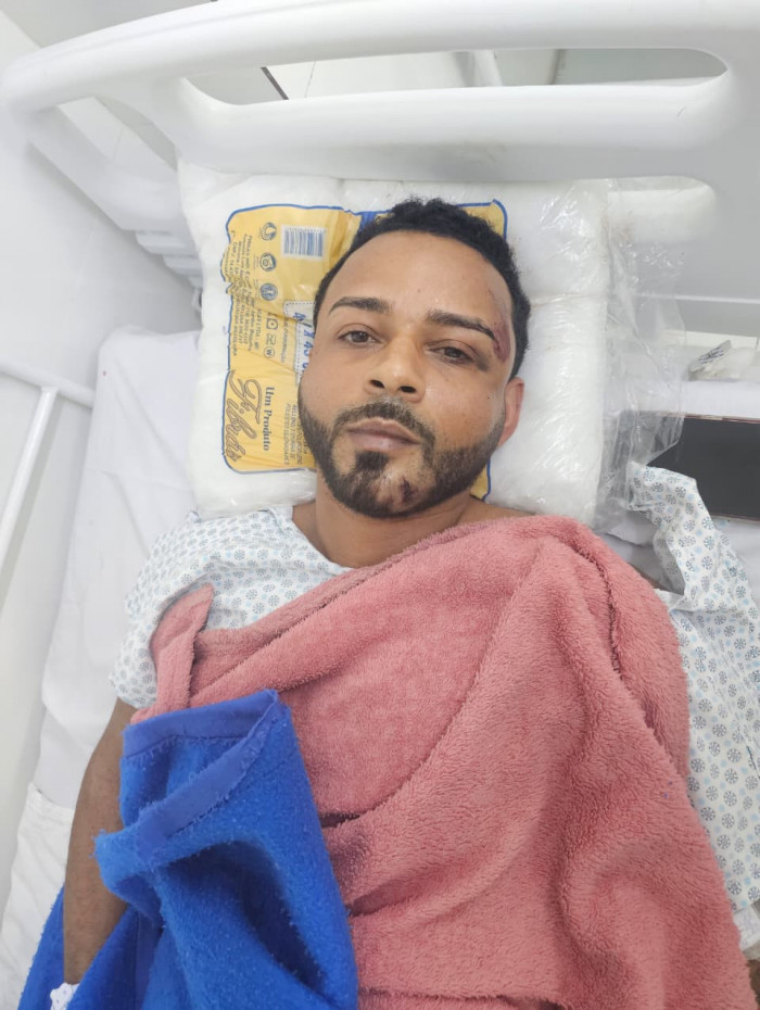 Cachoeira sofreu um acidente de moto e buscou atendimento no hospital