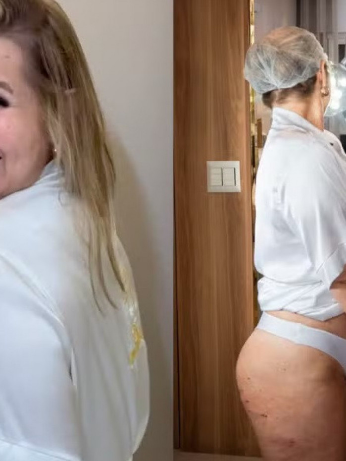Andr&eacute;a Sorvet&atilde;o realizou tratamento para celulite 