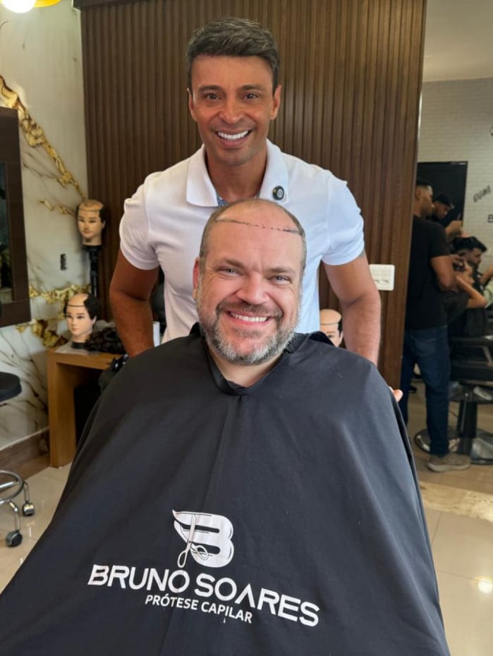 Profissional faz a preparação para a prótese ideal