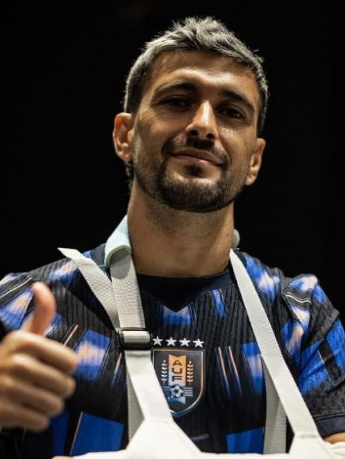 Arrascaeta sofreu les&atilde;o em amistoso com o Uruguai