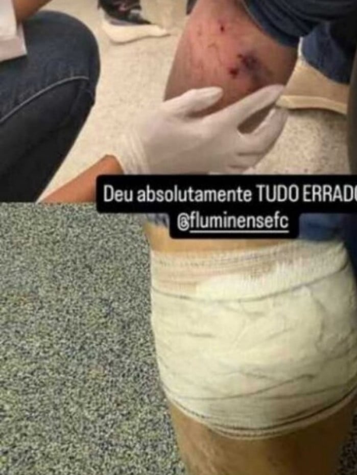 Casal de idosos foi atingido por uma bomba durante jogo do Fluminense dentro do Maracan&atilde;