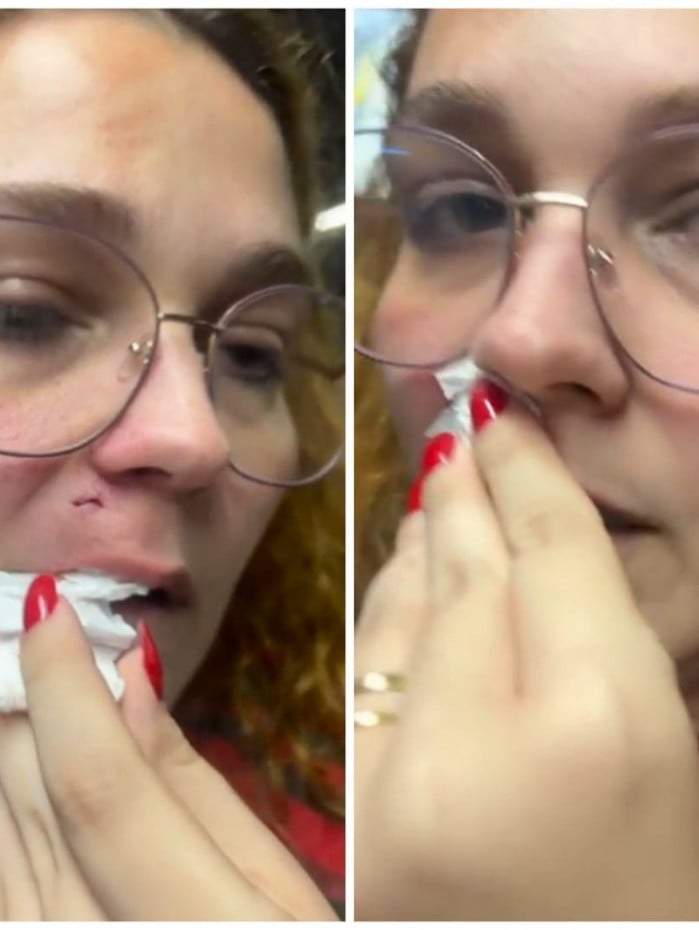 Mariana Fran&ccedil;a, de 29 anos, afirma que levou uma cassetada no rosto durante confus&atilde;o na esta&ccedil;&atilde;o de S&atilde;o Crist&oacute;v&atilde;o