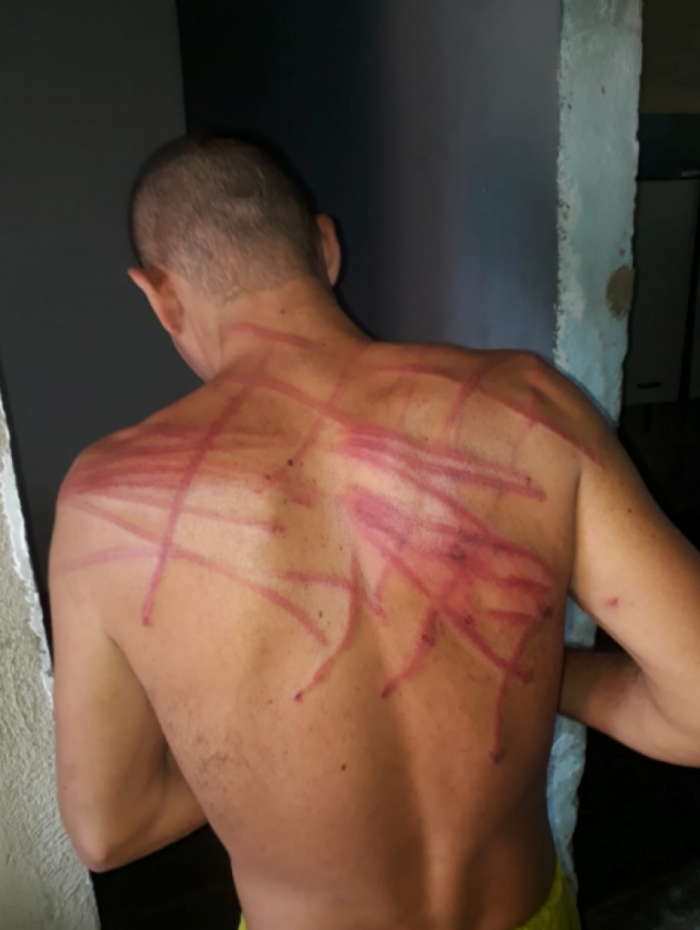 Rapaz foi agredido com tapas e fios